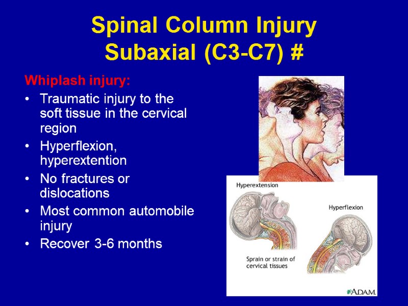 Spinal Column Injury Subaxial (C3-C7) # Whiplash injury: Traumatic injury to the soft tissue